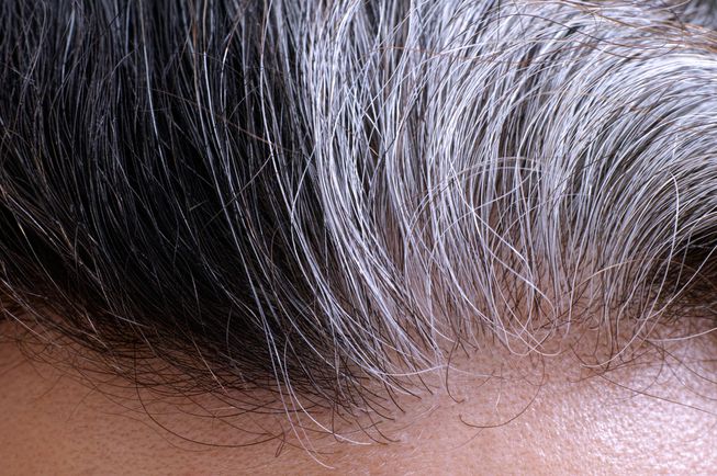 Early greying of hair ups heart disease risk: study
