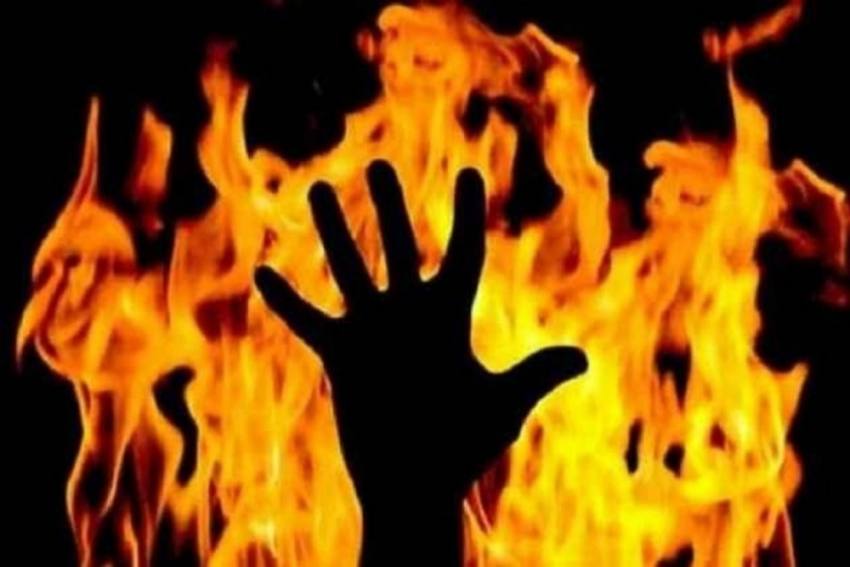 Delhi woman burnt by her live-in partner, succumbs to injuries