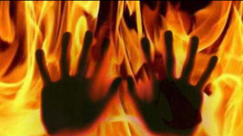 Woman, lover held for burning husband alive in Hyderabad