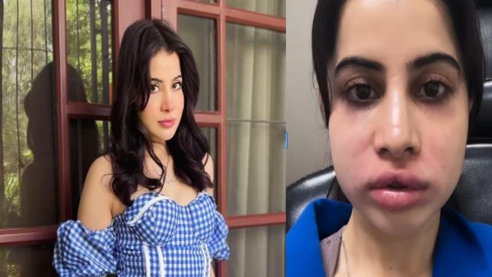 Uorfi Javed shuts down trolls, shows face without fillers