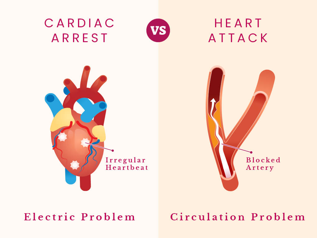 hereare5effectivewaystopreventheartburn