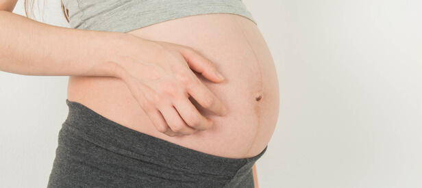 hereareskinissuessymptomsduringpregnancy