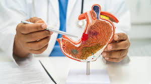 Persistent acidity and weight loss could be early signs of GI cancer