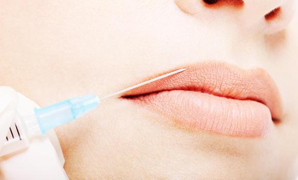lipsdon’tliekeepthemingoodshape