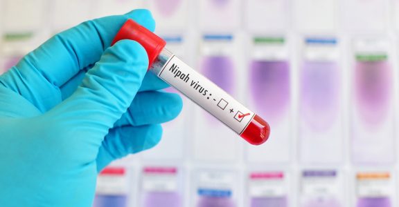 keralaonhighalertafterteentestspositivefornipahvirus