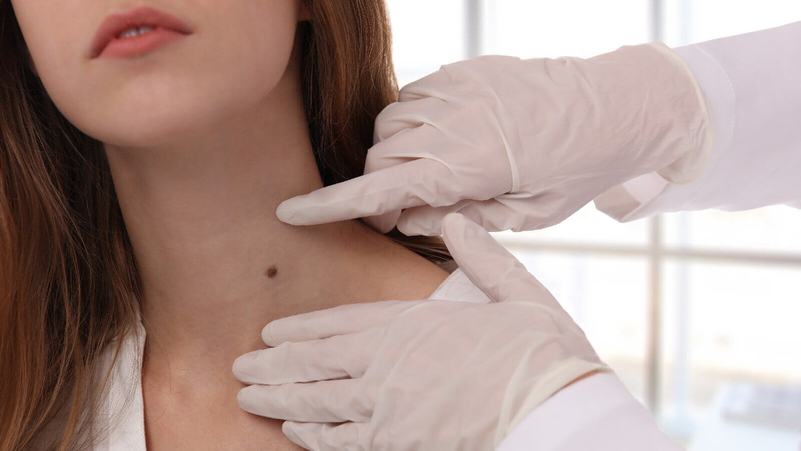 hereare5signsofhighbloodsugaryoucanspotonyourskin