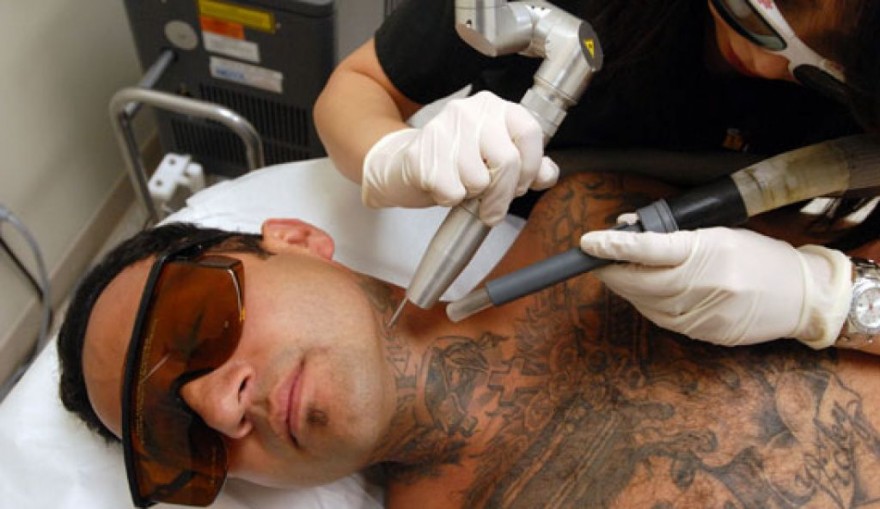 Tattoo therapy may help treat multiple sclerosis:study.