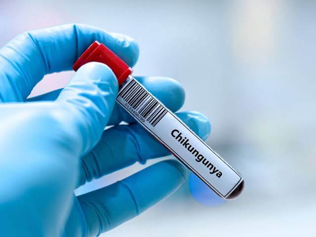 US issues travel advisory amid chikungunya outbreak