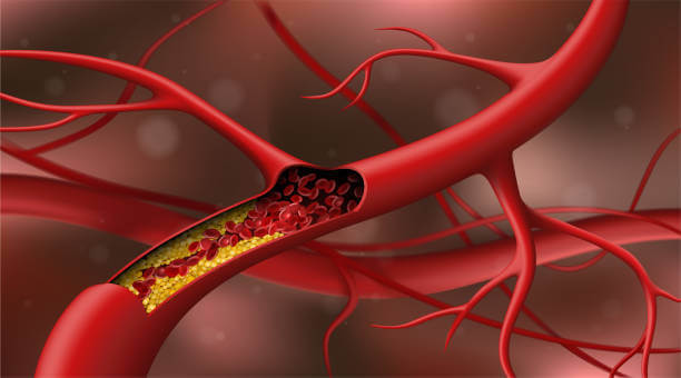 Know 7 ayurvedic remedies to unclog your blocked arteries naturally