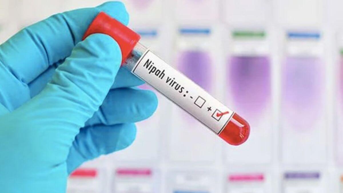 West Bengal reports 1st Nipah death, 25-year-old nurse succumbs to virus