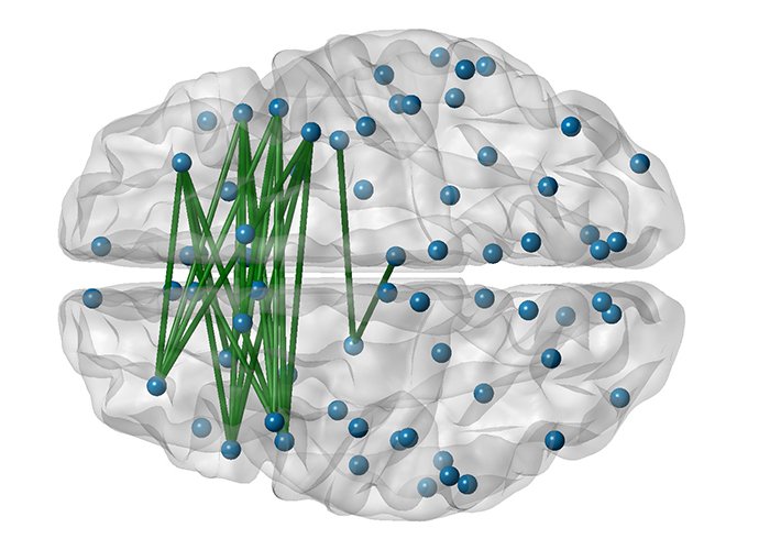 creativepeoplehavebetterconnectedbrains:study