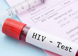 UN warns 4 million could die from AIDS by 2029 as U.S. cuts HIV funding