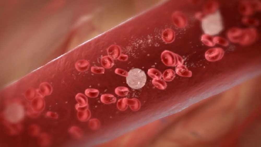 lowsunlightandvitamindleadstohighriskofleukemia