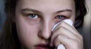 Know the signs of Monsoon eye infections