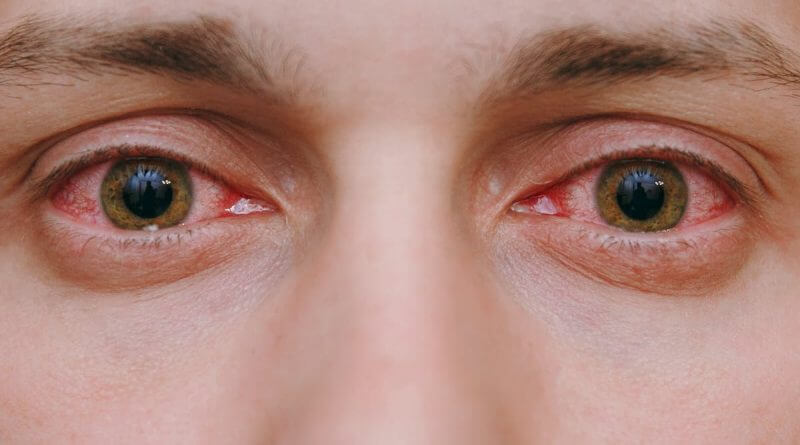 hereshowincreasingairpollutioncancauseeyeproblems