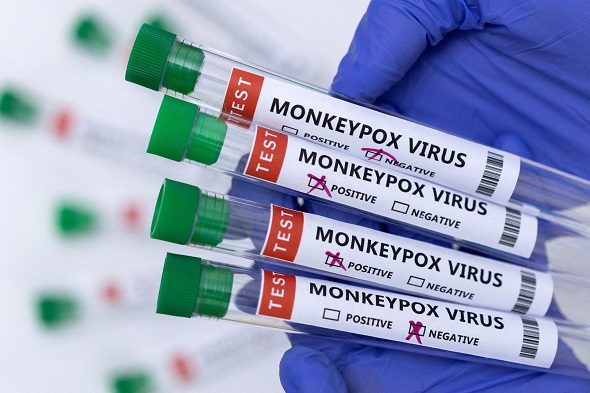 Health experts says, Monkeypox non-fatal disease