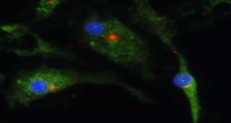 scientistsdevelopmoleculetotreatinflammatorydiseases