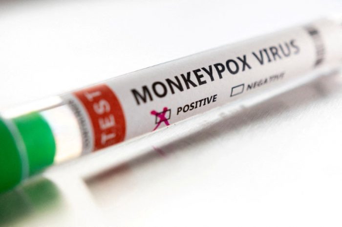 Brazil confirms 1st monkeypox-related death