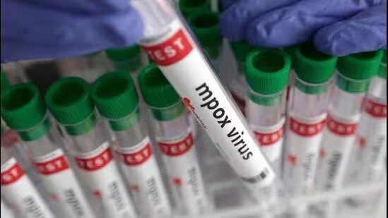 indiadevelopsindegenousrtpcrtestingkitformpox