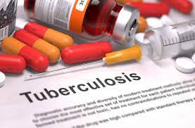 knowhowthesedeficiencyofthisvitaminincreasesriskoftuberculosis