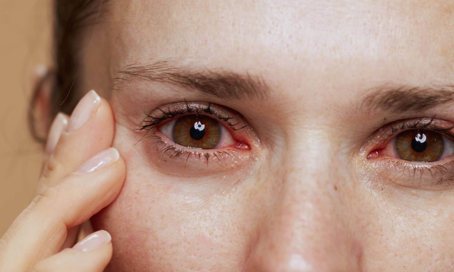 AIIMS explores milk-protein tablet as natural remedy for dry eyes