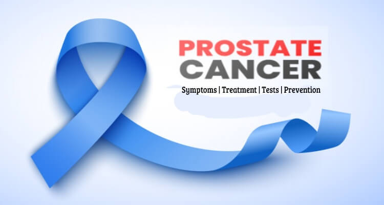 Know causes, symptoms and treatment of prostate cancer which Joe Biden diagnosed