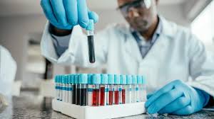 Blood test detects cancer DNA three years before diagnosis
