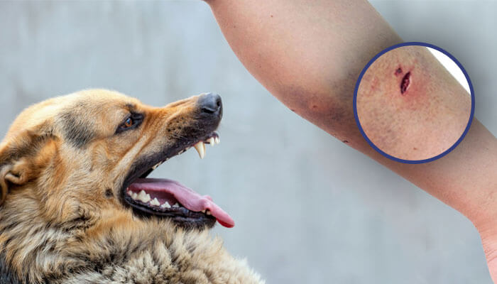 Rabies kills 5,700 Indians every year: Government aims for zero deaths by 2030