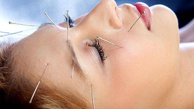 acupunctureasafealternativetopainkillersinemergencydepartments