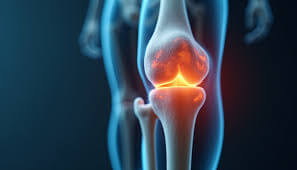 40% rise in hip replacements among post-Covid patients in their 30s and 40s