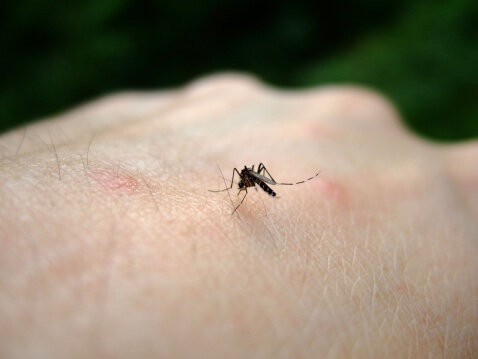 mosquitobitescanbereallyirritatingtipsonhowtopreventthem