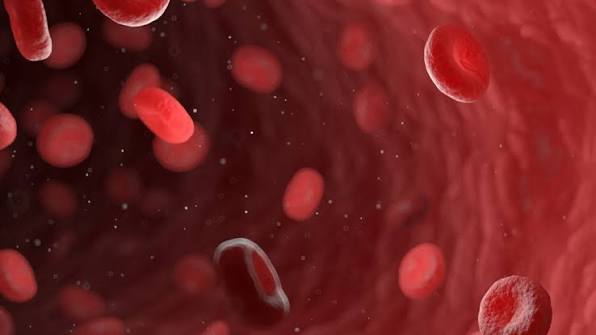 patients-who-suffer-heart-attack-have-more-micro-and-nanoplastic-in-their-blood-study