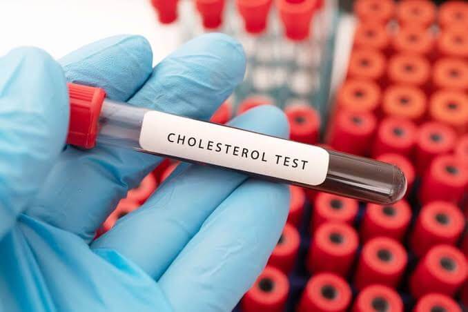Nearly 90% of Indians have abnormal cholesterol levels: ICMR study