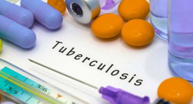 twonewvaccinesmaybeeffectiveinpreventingtuberculosis:study