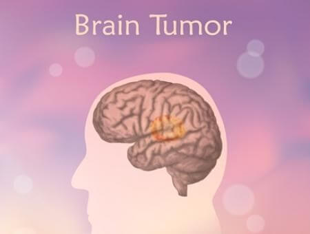 Know symptoms diagnosis of brain tumour in kids