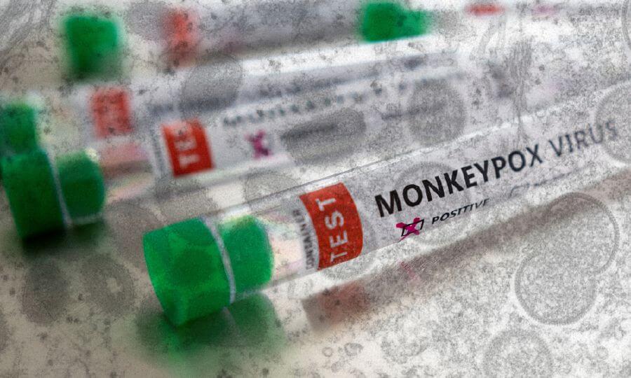 delhireportsfirstcaseofmonkeypoxseparateisolationwardsetupatlnjphospital