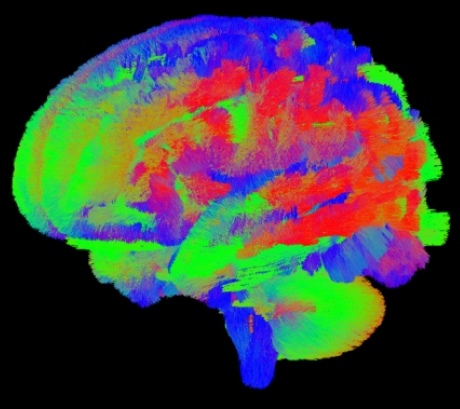 scientiststrackbraindevelopmentsofnewbornbabies