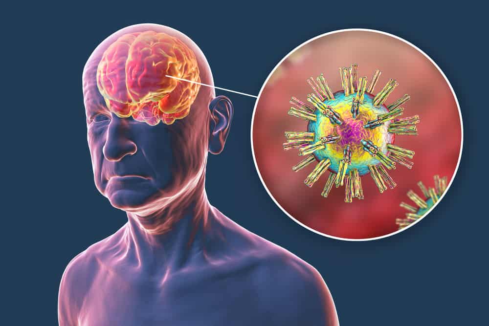 scientistsdiscovercommonviruscouldbecausingalzheimersdisease