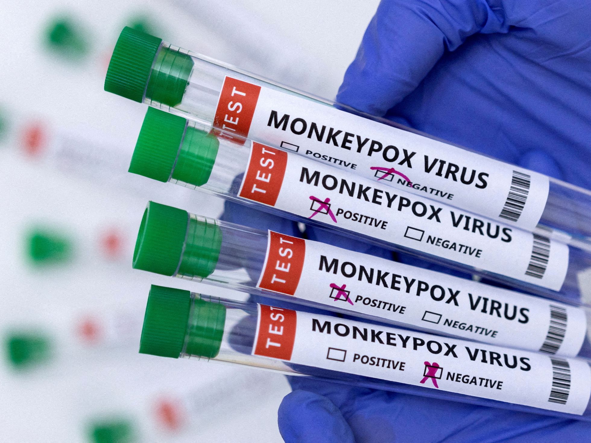 US declares public health emergency over monekypox outbreak