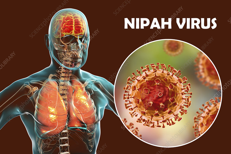 Nipah Virus Case Reported in Malappuram, Kerala