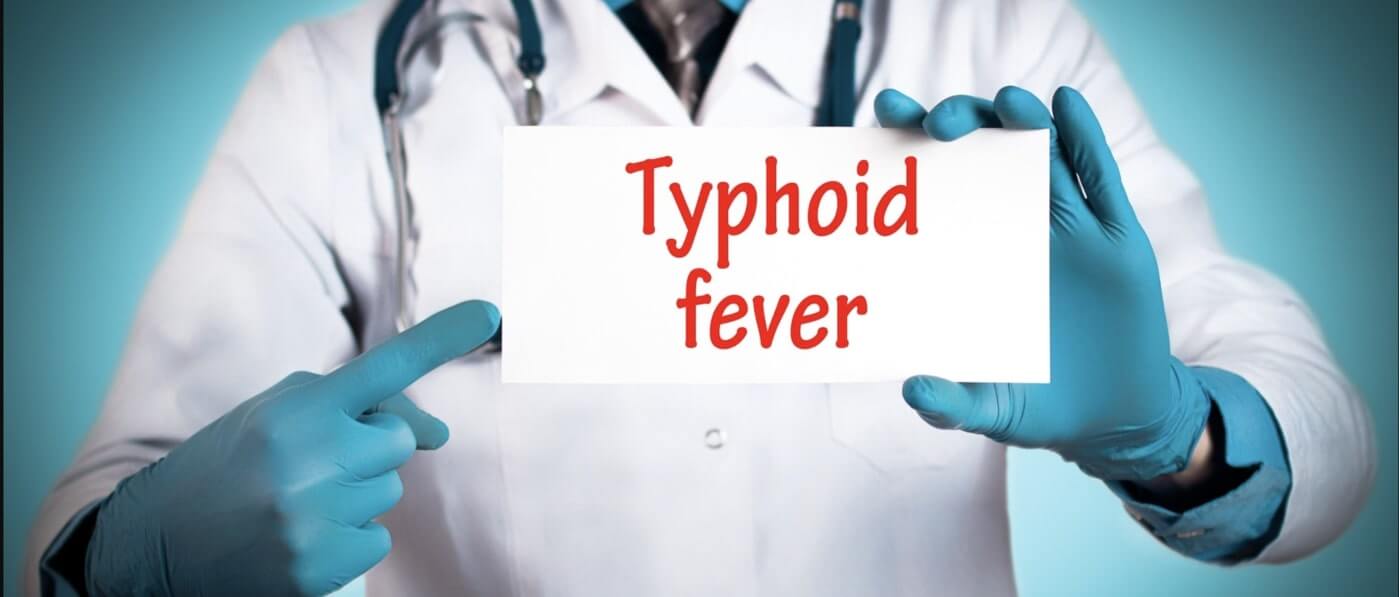 Early signs of typhoid fever you shouldn