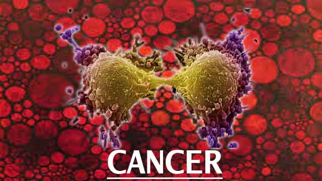 nanotechnologytodetectadvancecancer