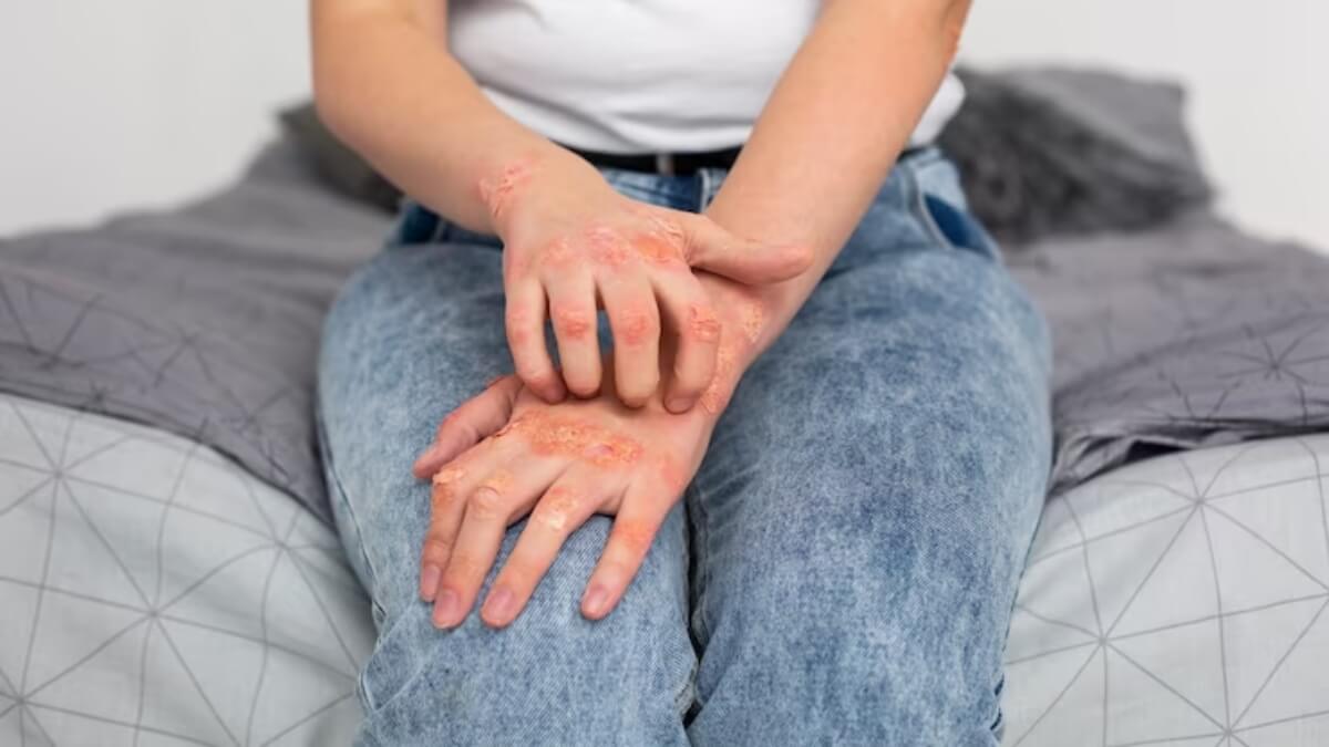 hereare6essentialstepstopreventmonsoonallergies