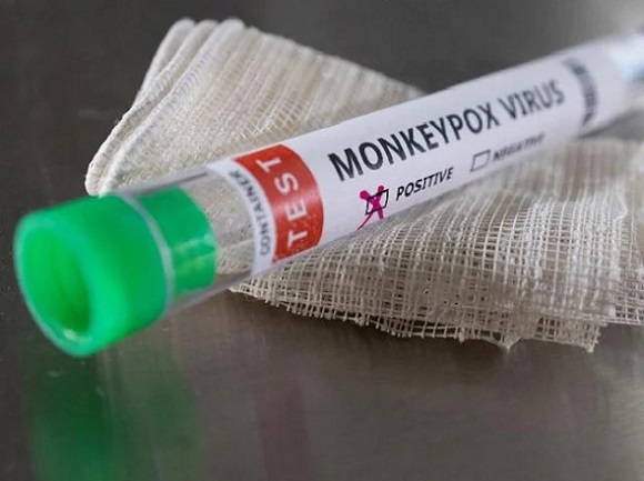 Samples from Telangana’s 1st suspected Monkeypox case sent to NIV Pune on Monday
