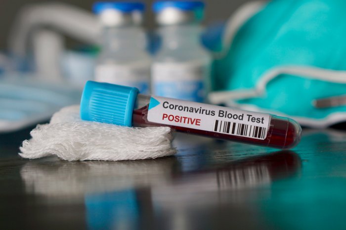 thirdcoronaviruscaseconfirmedinhyderabad