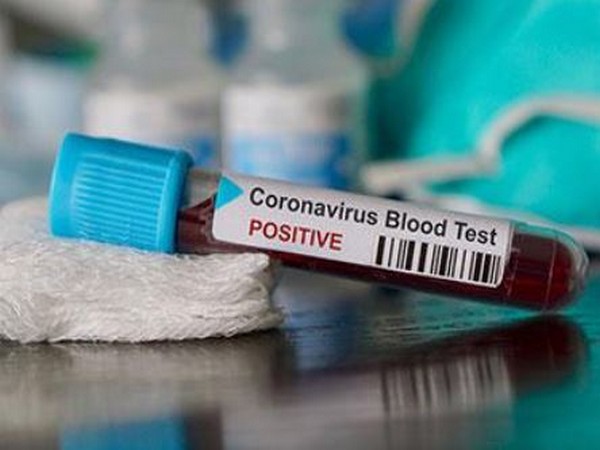 wardboyofprivatehospitalinpatnatestspositiveforcoronavirus