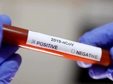 coronavirusoutbreak:maharashtragovttoallow8labstoconductonlycovid19tests