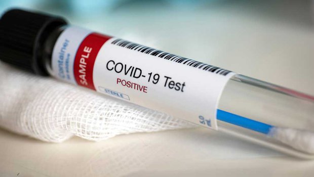 icmrtests3611599covid19samplesinindiasofar