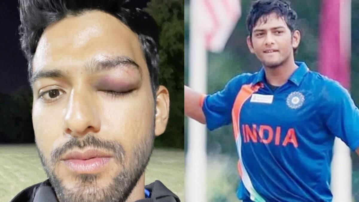 Former U-19 captain Unmukt Chand suffers eye injury in US