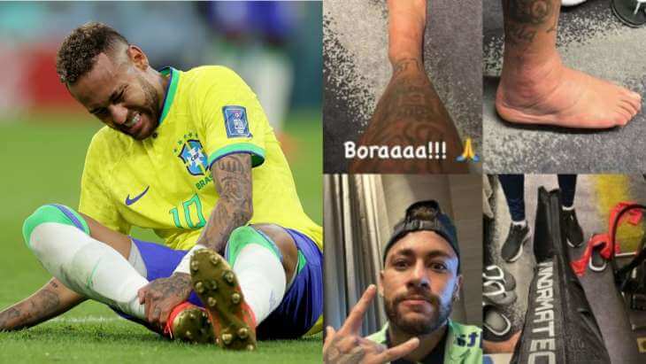 fifa-wc-2022-brazil-star-neymar-posts-picture-of-swollen-ankle-ahead-of-clash-against-switzerland